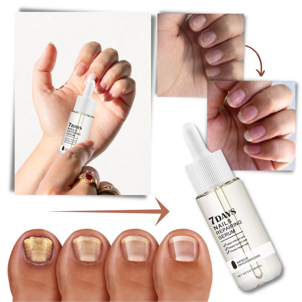 7 dagers neglereparerende essens
- Ozerty