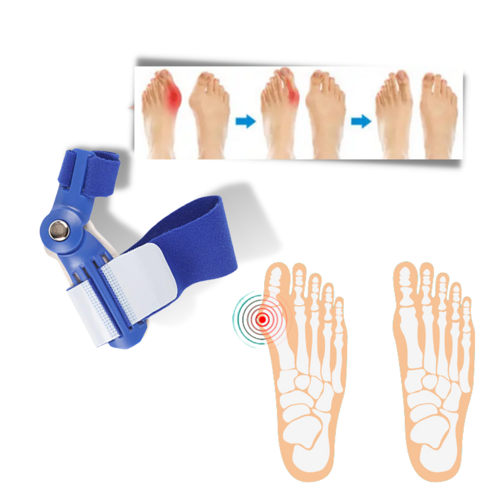 Ortopedisk hallux valgus korrigerer - Ozerty