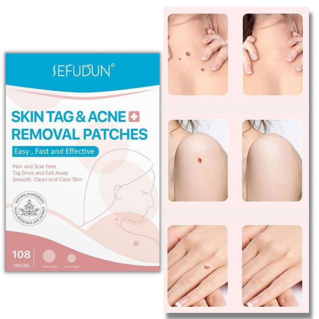 Behandlingsplaster for fjerning av hudmerker - Ozerty