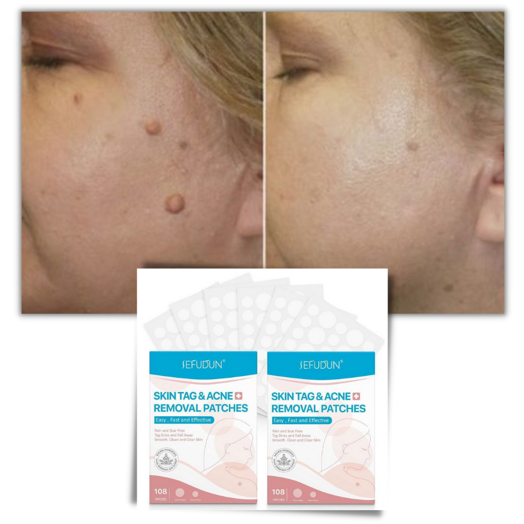 Behandlingsplaster for fjerning av hudmerker - Ozerty