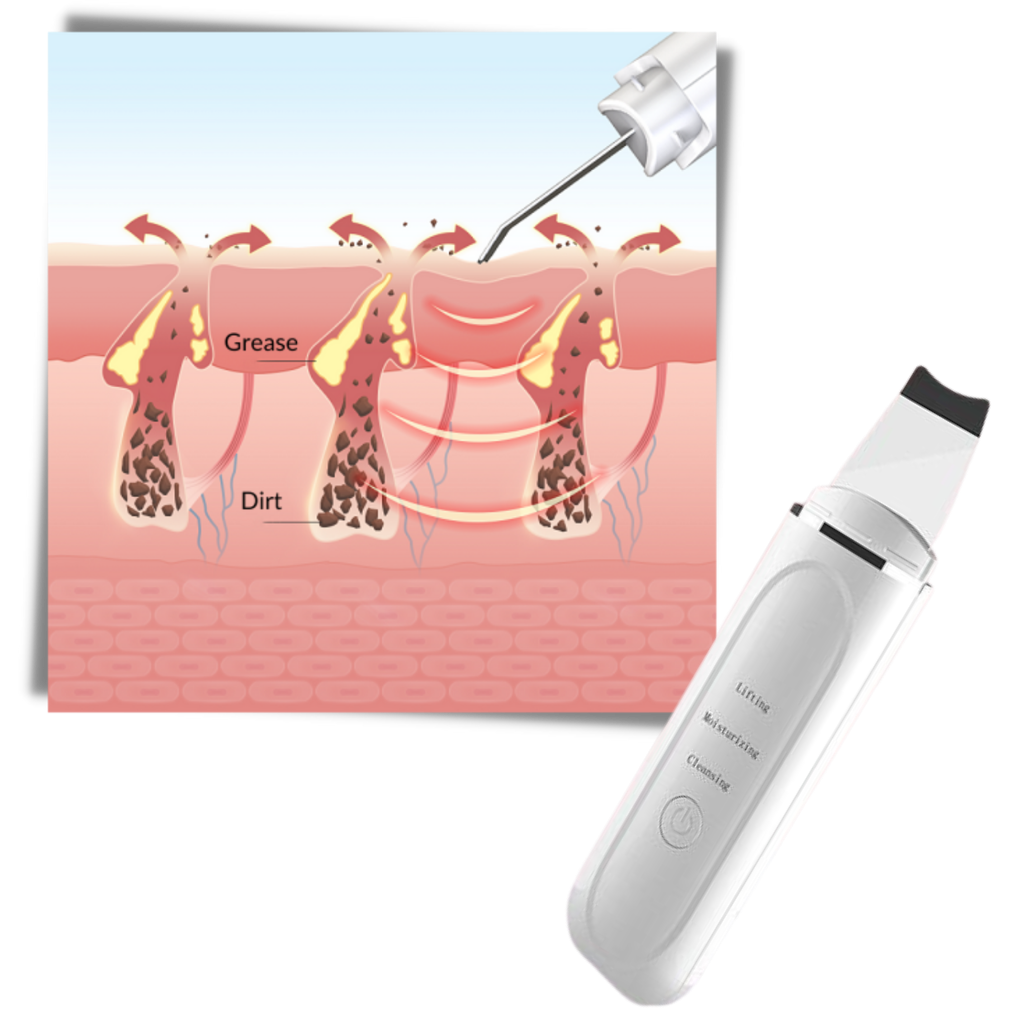 Ultrasonisk dyprensende ansiktsskrubber - Ozerty