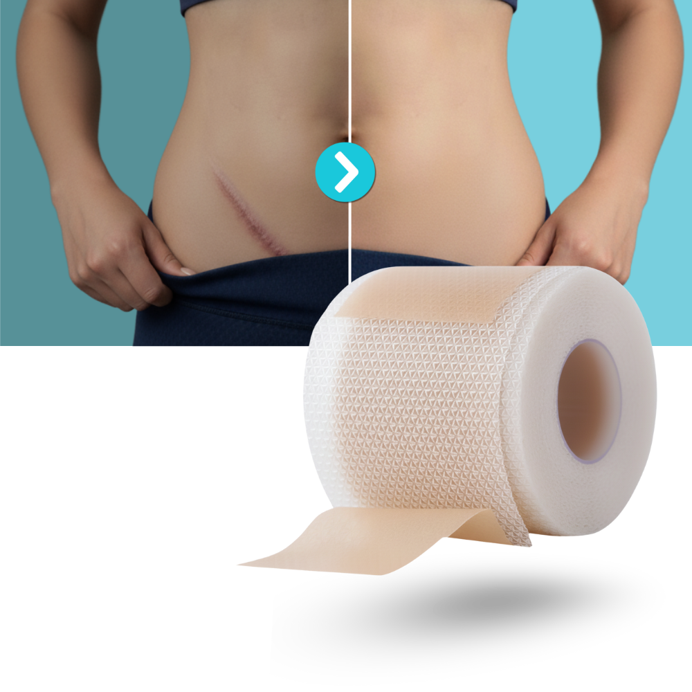 Hyaluronisk Silikonplaster for Arr - Ozerty