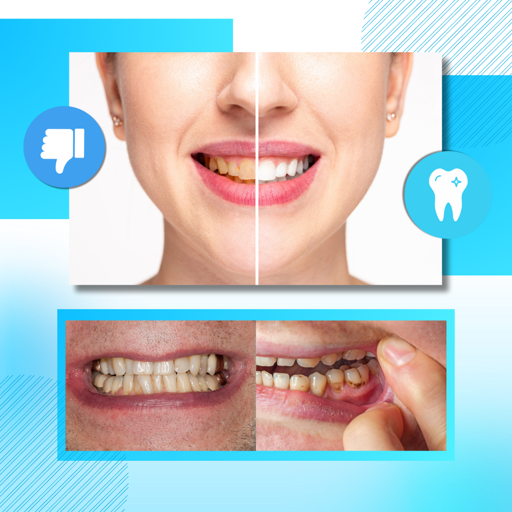 Mynteaktig Kull-Blekestrimler - Ozerty