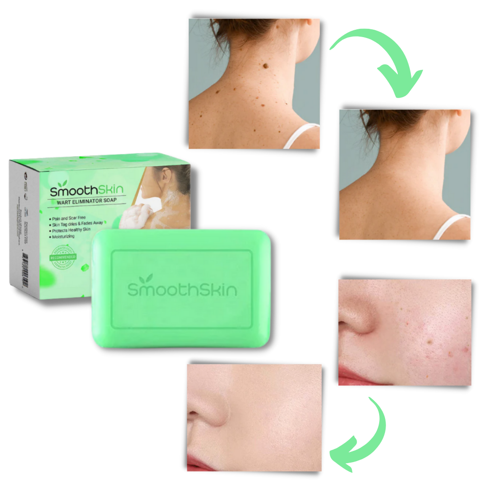 Fuktighetsgivende eksfolierende såpe for fjerning av vorter
- Ozerty