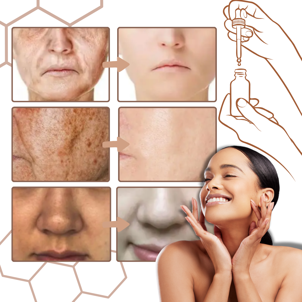 Ikke-fettete melanin-korrigerende ansiktsserum - Ozerty