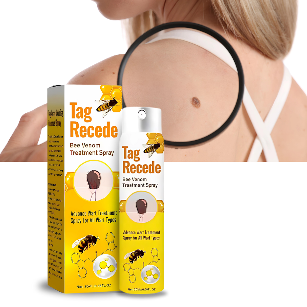 Ikke-Invasiv Fjerning av Merker - Ozerty