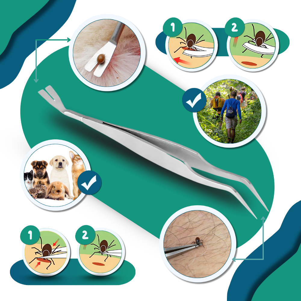 Flåttklype med Presisjon - Ozerty