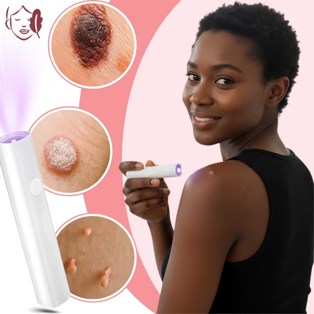 Kosmetisk Strålelaserpenn - Ozerty