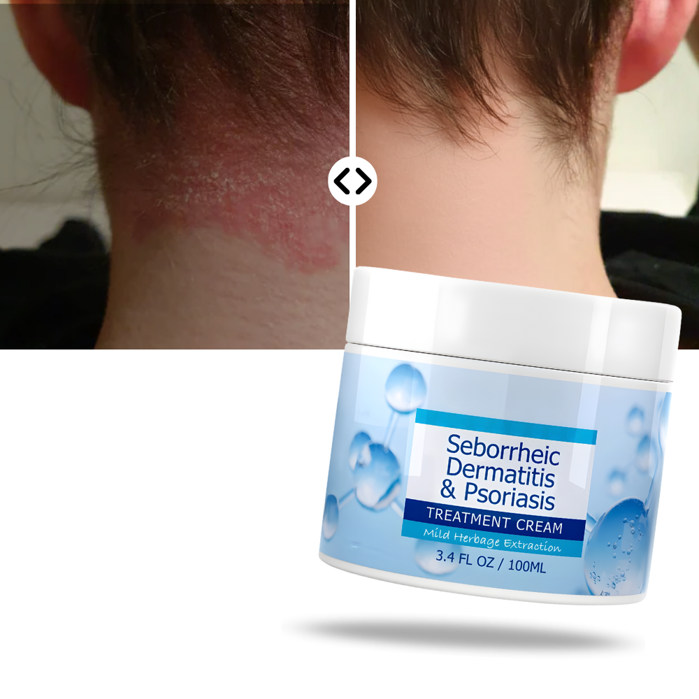 Fuktighetskrem For Hodebunn - Ozerty