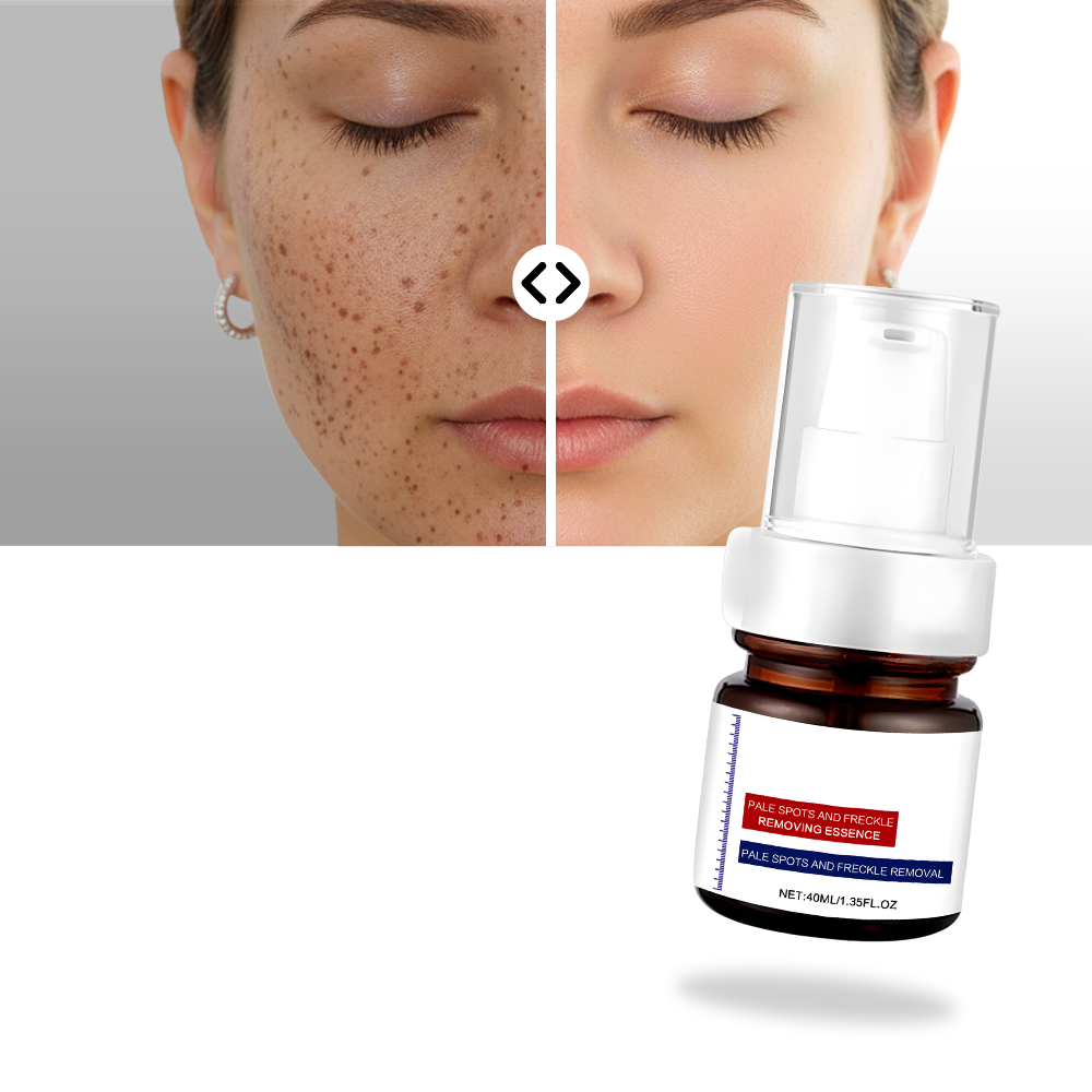 Silkeaktig Kojic-Serum For Hudglød - Ozerty