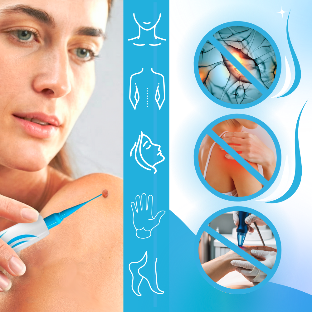 Proff Hudmerke-Fjerner - Ozerty