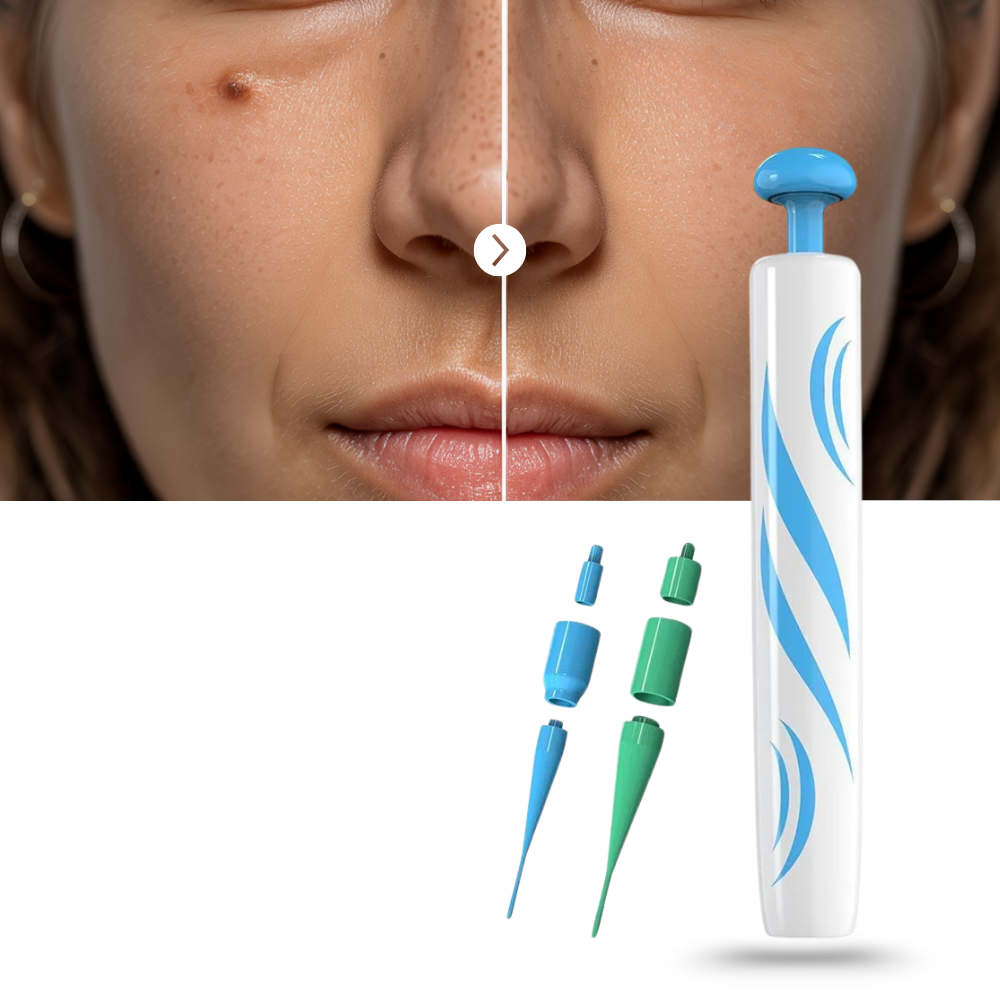 Proff Hudmerke-Fjerner - Ozerty