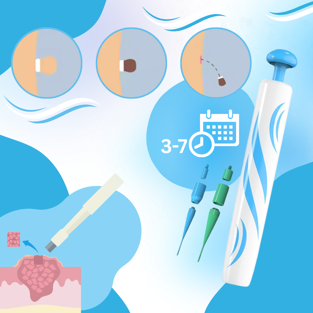 Proff Hudmerke-Fjerner - Ozerty