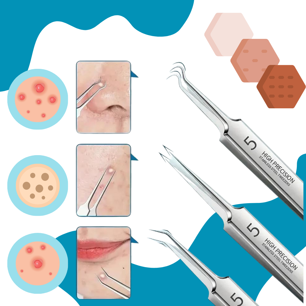 Ultrapresis spiss pinsett - Ozerty