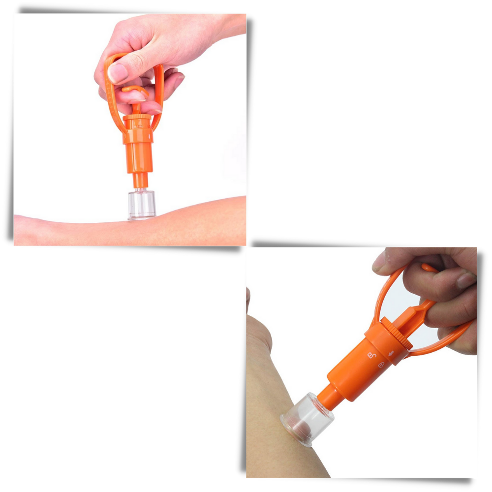 Nødsett for uttrekking av gift - Ozerty