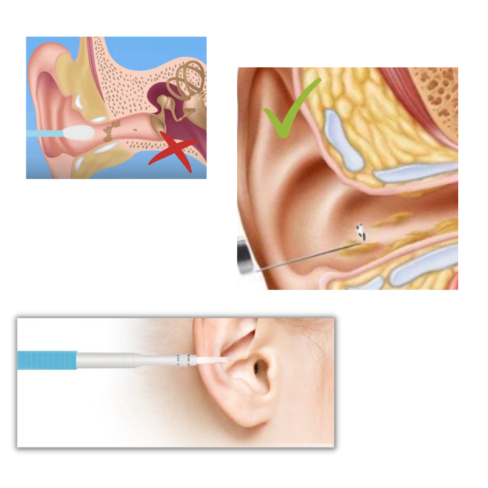 3 i 1 ørekamera - Ozerty