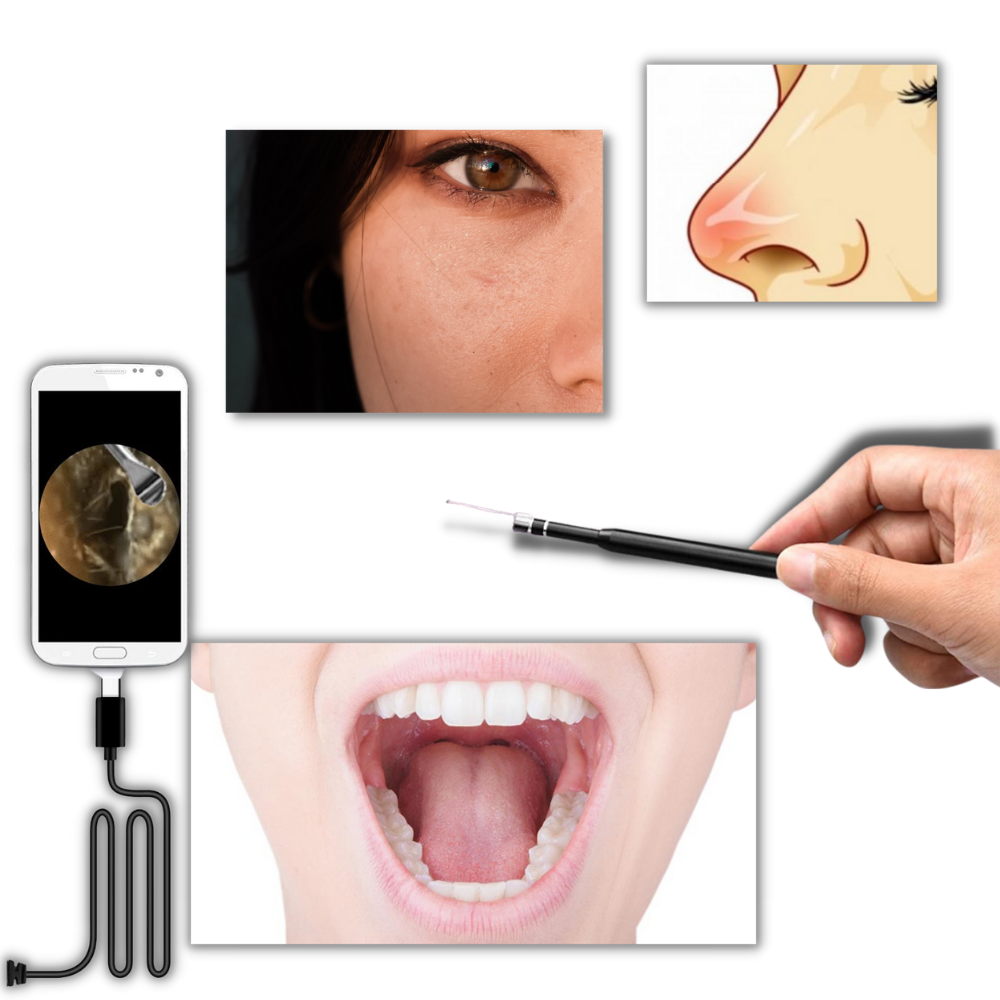 3 i 1 ørekamera - Ozerty