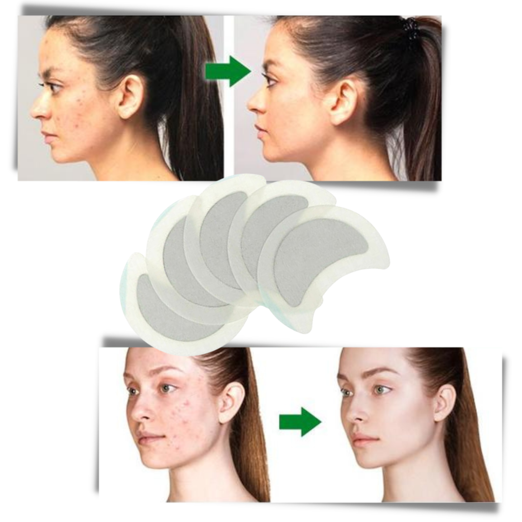 5 x Anti-svette urte-lymfeplaster - Ozerty