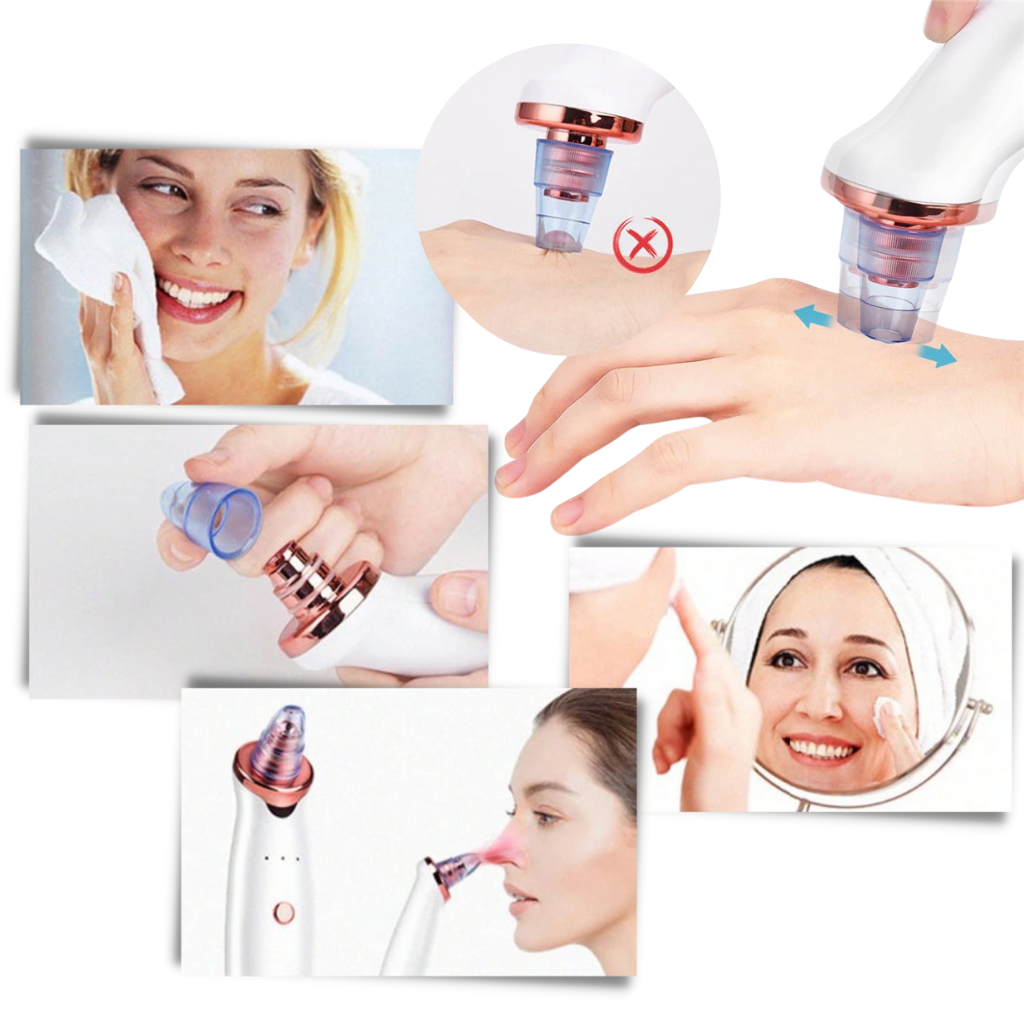 Hudormefjerner - Ozerty