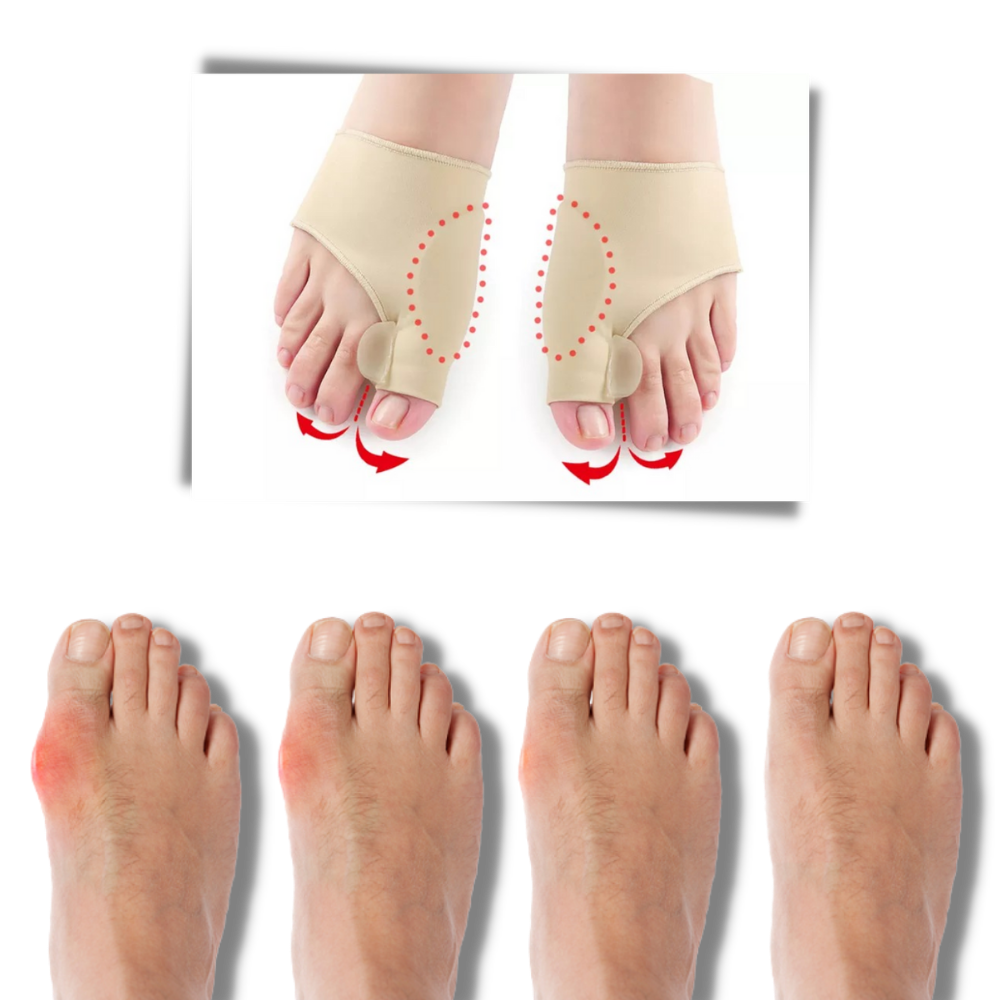 Gel hallux valgus justering - Onorge