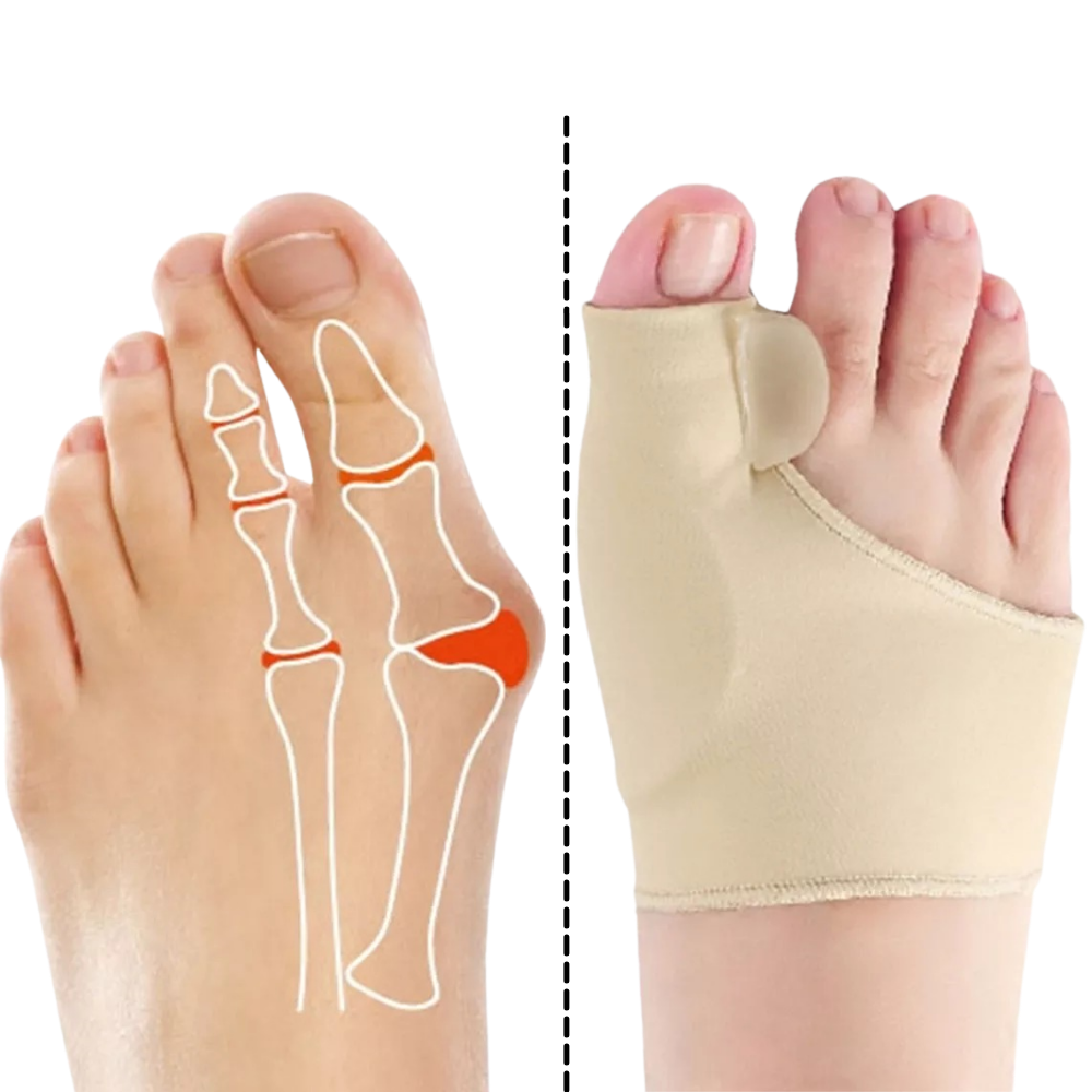 Gel hallux valgus justering - Onorge