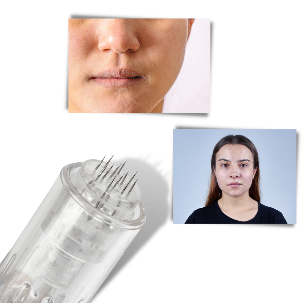 Dermal Microneedling Pen - Ozerty