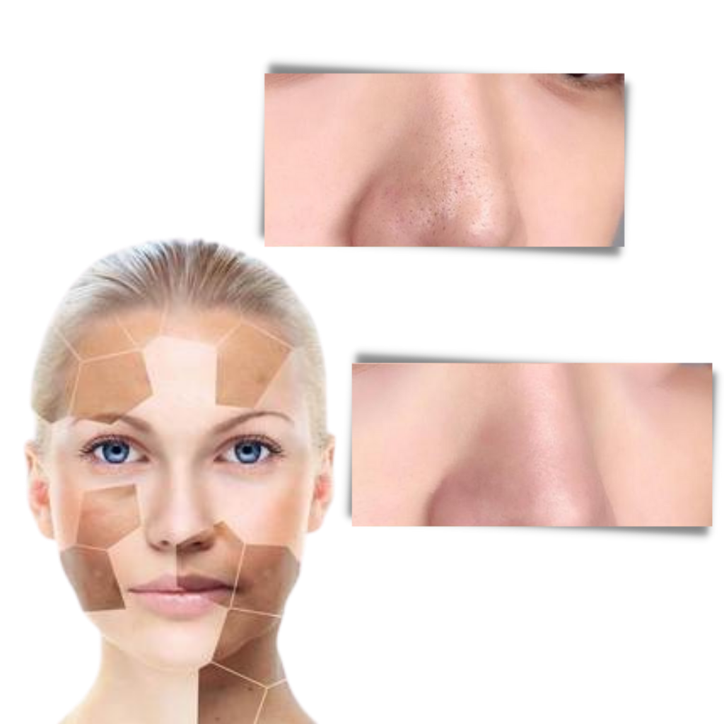 Poreløs dyptrensende grønn te maske for å fjerne hudormer - Ozerty