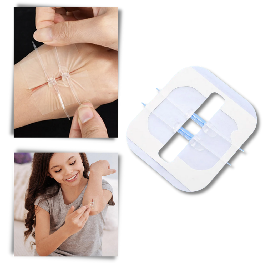 Vanntett klebemiddel for sår
- Ozerty