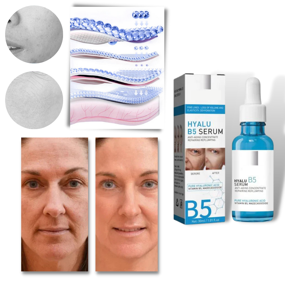 Foryngende hyaluronsyreserum med Hyalu B5 Hyaluronsyre
- Ozerty