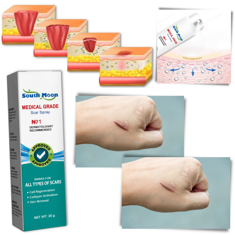 Spraybehandling for fjerning av arr
- Ozerty