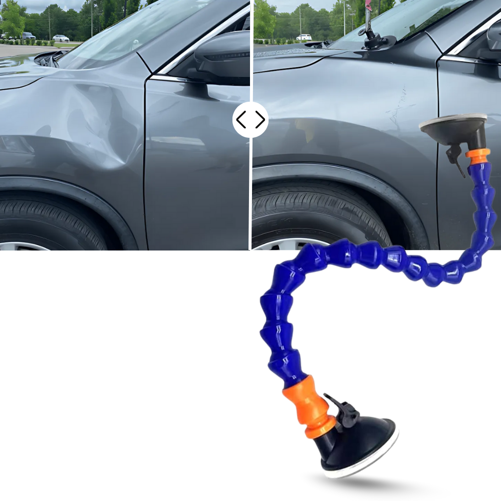 Dent Master Sugekopp - Ozerty