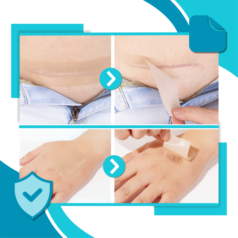 Hyaluronisk Silikonplaster for Arr - Ozerty