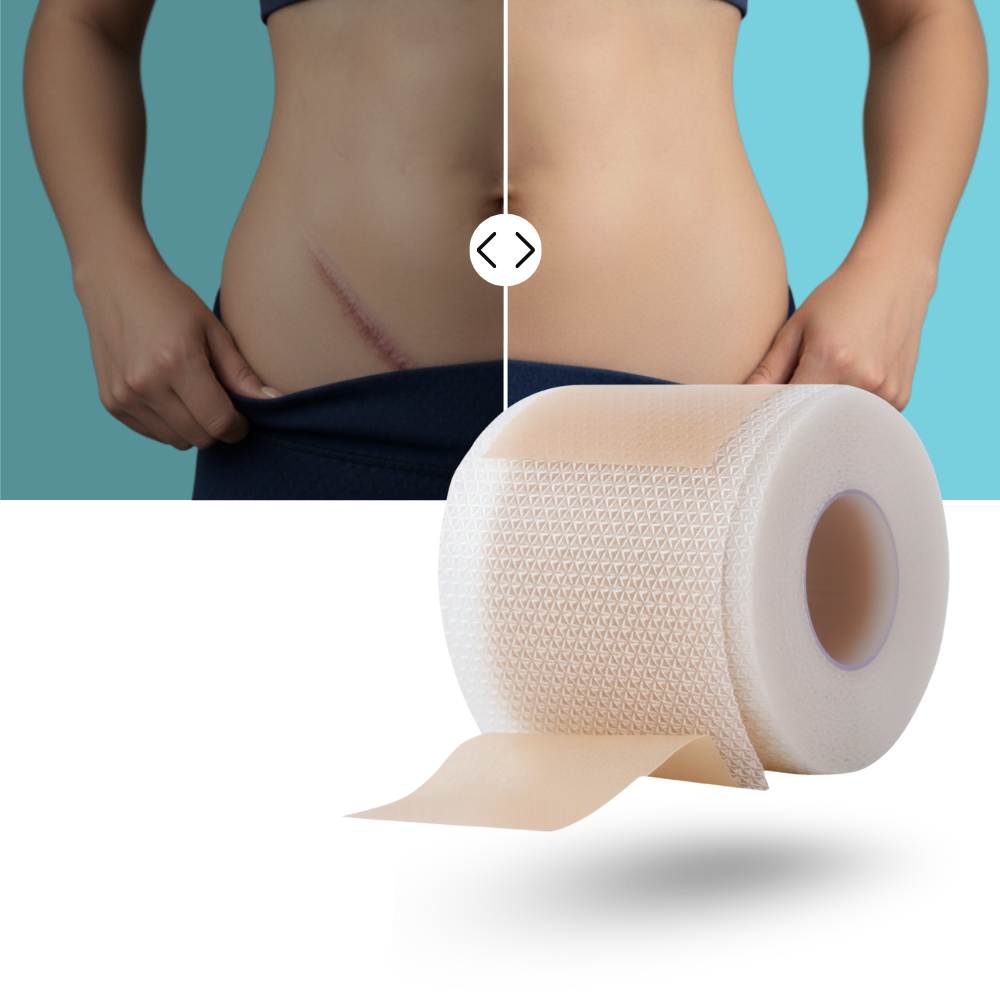 Hyaluronisk Silikonplaster for Arr