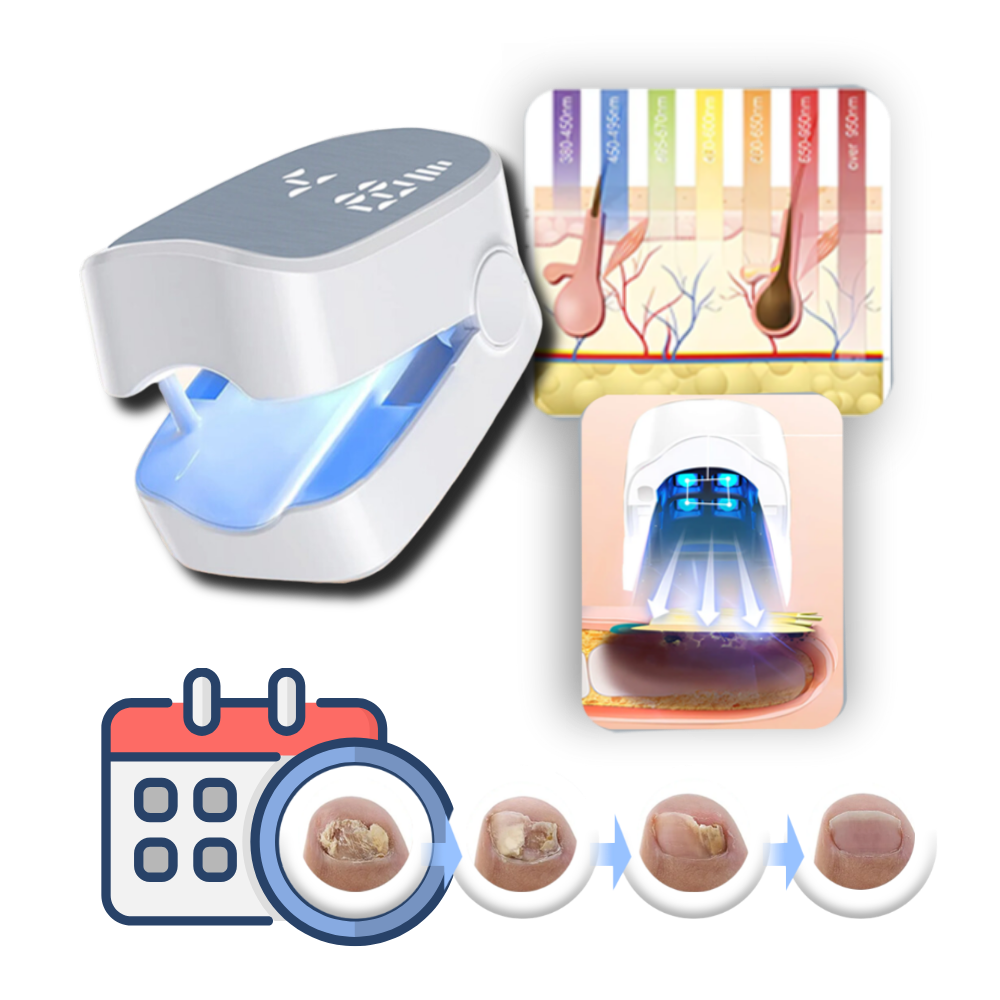 Smertefri Neglesopp-Laser - Ozerty