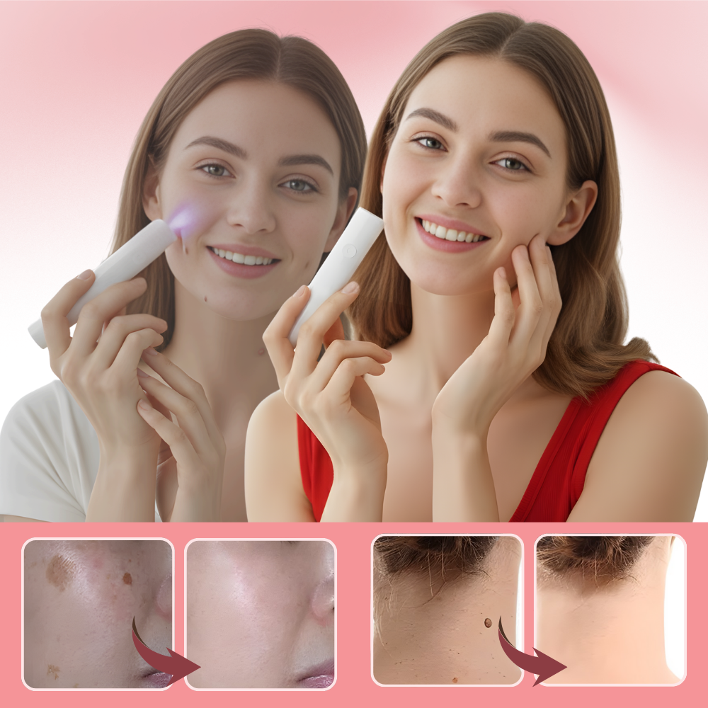 Kosmetisk Strålelaserpenn - Ozerty