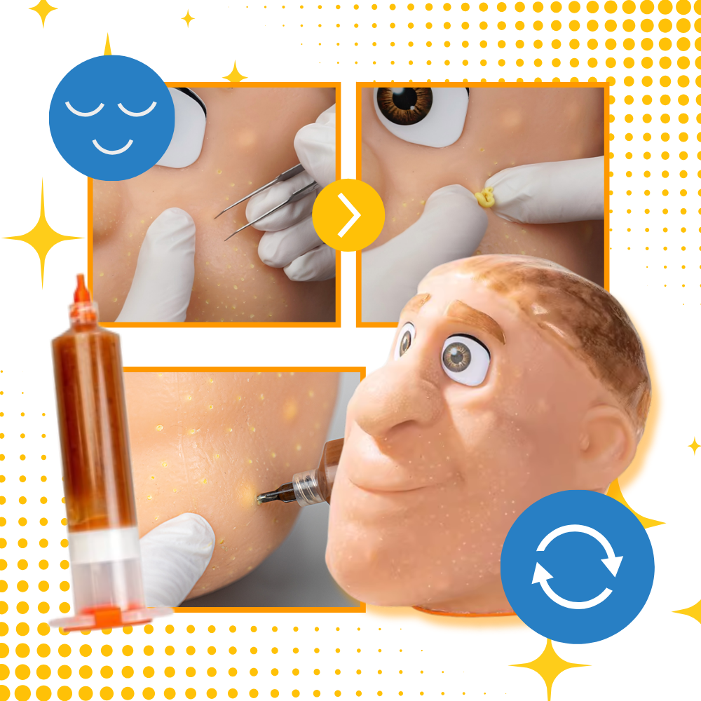 Avslappende Kvisepop-Leke I Silikon - Ozerty