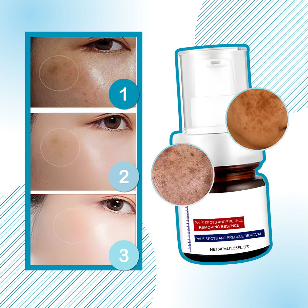 Silkeaktig Kojic-Serum For Hudglød - Ozerty